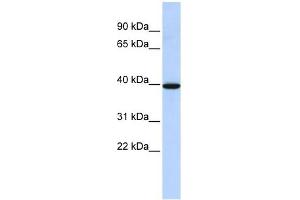 NMBR antibody used at 1 ug/ml to detect target protein. (NMBR Antikörper  (N-Term))