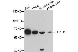 Western blot analysis of extracts of various cell lines, using FOXO1 antibody. (FOXO1 Antikörper  (AA 340-580))