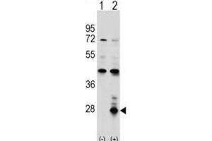 Western Blotting (WB) image for anti-Azurocidin 1 (AZU1) antibody (ABIN2998391) (Azurocidin Antikörper)