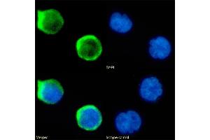 Immunofluorescence staining of fixed Jurkat cells with anti-CD1a antibody CBT6. (Rekombinanter CD1a Antikörper)
