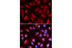 Immunofluorescence analysis of U2OS cells using MCM5 antibody (ABIN5973237). (MCM5 Antikörper)