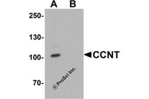 Western Blotting (WB) image for anti-Cyclin T1 (CCNT1) (C-Term) antibody (ABIN1077437) (Cyclin T1 Antikörper  (C-Term))