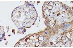 Immunohistochemistry of paraffin-embedded Human placenta using AGT Polyclonal Antibody at dilution of 1:100 (40x lens). (AGT Antikörper)