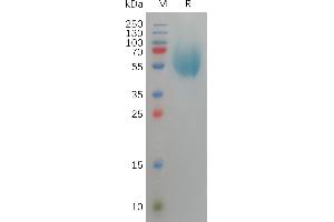 Human CEA Protein, His Tag on SDS-PAGE under reducing condition.