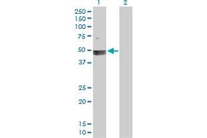 Western Blot analysis of SMARCB1 expression in transfected 293T cell line by SMARCB1 MaxPab polyclonal antibody. (SMARCB1 Antikörper  (AA 1-385))