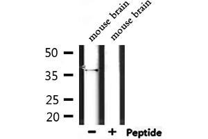 Western blot analysis of extracts from mouse brain, using OR4D5 Antibody. (OR4D5 Antikörper)