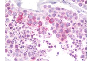 anti-Reticulon 4 Receptor-Like 2 (RTN4RL2) (C-Term) antibody