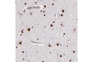 Immunohistochemical staining of human cerebral cortex with NUP62CL polyclonal antibody  shows strong nuclear positivity in neuronal cells at 1:200-1:500 dilution.