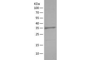 HIF1A Protein (AA 574-799) (His tag)