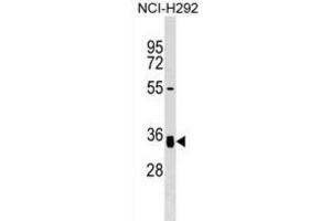 Western Blotting (WB) image for anti-N-Acetylglucosamine-1-Phosphate Transferase, gamma Subunit (GNPTG) antibody (ABIN3000049)