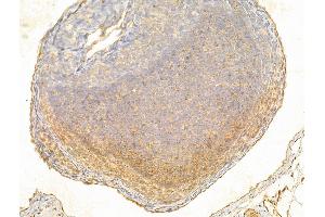 ABIN6261598 and ABIN6266535 at 1/100 staining Rat kidney tissue by IHC-P. (ERK1/2 Antikörper)