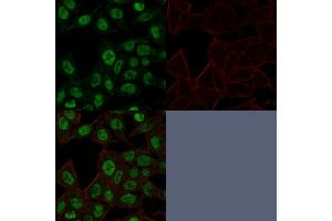 Confocal Immunofluorescence image of HeLa cells using Topo II alpha, Monoclonal Antibody (TOP2A/1361). (Topoisomerase II alpha Antikörper  (AA 1352-1493))
