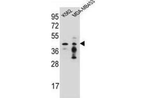 Western Blotting (WB) image for anti-Phosphate Cytidylyltransferase 1, Choline, alpha (PCYT1A) antibody (ABIN2996564) (PCYT1A Antikörper)