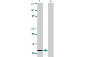 Western Blot analysis of S100A1 expression in transfected 293T cell line by S100A1 monoclonal antibody (M01), clone 1D5. (S100A1 Antikörper  (AA 1-75))