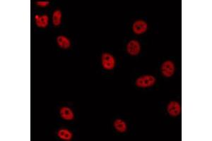 ABIN6274890 staining HepG2 by IF/ICC. (DDX51 Antikörper  (C-Term))