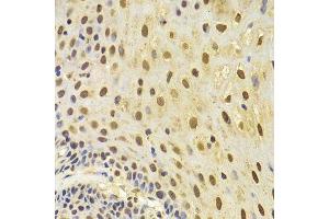 Immunohistochemistry (Paraffin-embedded Sections) (IHC (p)) image for anti-Keratin 8 (KRT8) (AA 1-483) antibody (ABIN3021288)