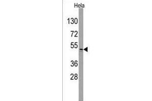 Western blot analysis of anti-ILK Antibody  (ABIN391996 and ABIN2841782) in Hela cell line lysates (35 μg/lane).