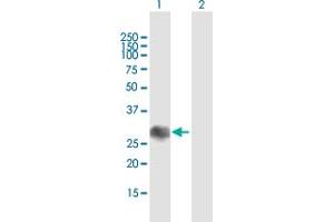 Western Blot analysis of SOCS1 expression in transfected 293T cell line by SOCS1 MaxPab polyclonal antibody. (SOCS1 Antikörper  (AA 1-211))