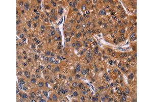 Immunohistochemistry (IHC) image for anti-Nuclear Factor of Activated T-Cells, Cytoplasmic, Calcineurin-Dependent 3 (NFATC3) antibody (ABIN2827896) (NFATC3 Antikörper)