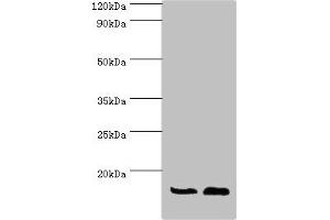 Western blot All lanes: ATP5J antibody at 7 μg/mL Lane 1: Rat brain tissue Lane 2: Mouse heart tissue Secondary Goat polyclonal to rabbit IgG at 1/10000 dilution Predicted band size: 13, 14 kDa Observed band size: 13 kDa (ATP5J Antikörper  (AA 1-108))