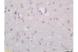 Formalin-fixed and paraffin embedded rat brain labeled with Rabbit Anti-TSHR Polyclonal Antibody (ABIN677378) at 1:200 followed by conjugation to the secondary antibody and DAB staining