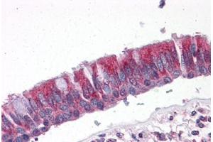 Human Lung, Respiratory Epithelium: Formalin-Fixed, Paraffin-Embedded (FFPE) (CCT2 Antikörper  (AA 277-473))