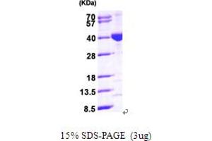 SDS-PAGE (SDS) image for Mitochondrial Trans-2-Enoyl-CoA Reductase (MECR) (AA 54-373) protein (His tag) (ABIN667794)