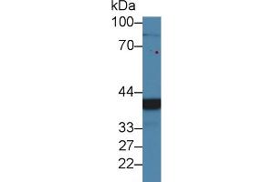 Western blot analysis of Human 293T cell lysate, using Mouse CHRDL1 Antibody (2 µg/ml) and HRP-conjugated Goat Anti-Rabbit antibody (