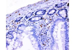 IHC analysis of VIP using anti-VIP antibody (ABIN4886760). (Vip Antikörper  (Middle Region))