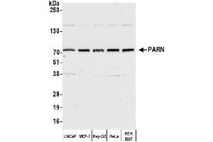 Western Blotting (WB) image for anti-Poly A Specific Ribonuclease (PARN) (AA 589-639) antibody (ABIN7454930) (PARN Antikörper  (AA 589-639))
