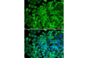 Immunofluorescence analysis of HeLa cells using Galactosidase alpha (Galactosidase alpha (GLA)) antibody (ABIN6131511, ABIN6141114, ABIN6141116 and ABIN6218799). (GLA Antikörper  (AA 150-429))