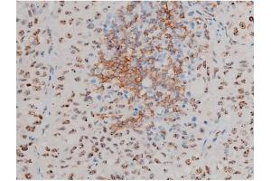 Immunohistochemistry (IHC) image for anti-Jun D Proto-Oncogene (JUND) (pSer255) antibody (ABIN6255135)