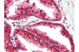 Human Prostate (formalin-fixed, paraffin-embedded) stained with TSLPat 2. (Thymic Stromal Lymphopoietin Antikörper)