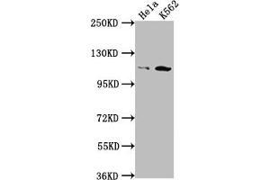 Western Blot Positive WB detected in: Hela whole cell lysate, K562 whole cell lysate All lanes: PIK3CB antibody at 1:1500 Secondary Goat polyclonal to rabbit IgG at 1/50000 dilution Predicted band size: 123 kDa Observed band size: 110 kDa (Rekombinanter PIK3CB Antikörper)