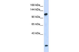 WB Suggested Anti-HEATR4 Antibody Titration: 0. (HEATR4 Antikörper  (N-Term))