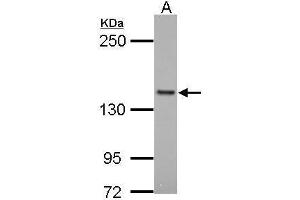WB Image Sample (30 ug of whole cell lysate) A: Raji 5% SDS PAGE antibody diluted at 1:1000 (Formin-Like 1 Antikörper)