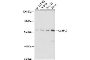 Western blot analysis of extracts of various cell lines, using OSBPL2 antibody (ABIN7269137) at 1:1000 dilution. (OSBPL2 Antikörper  (AA 291-480))