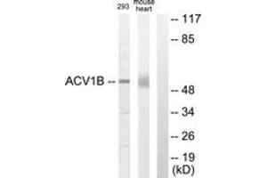 Western blot analysis of extracts from 293/mouse liver cells, using ACV1B Antibody.