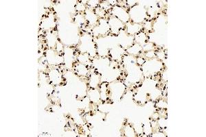 Immunohistochemistry of paraffin embedded mouse lung using rap1 (ABIN7075857) at dilution of 1: 2000 (400x lens) (RAP1 Antikörper)