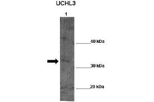 WB Suggested Anti-UCHL5 Antibody  Positive Control: Lane 1:341 µg Zebrafish skin lysate Primary Antibody Dilution: 1:0000Secondary Antibody: Anti-rabbit-HRP Secondry  Antibody Dilution: 1:0000Submitted by: William Tse (UCHL5 Antikörper  (Middle Region))