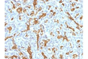 Formalin-fixed, paraffin-embedded human Pancreas stained with Cytokeratin 19 MAb (KRT19/799 + KRT19/800)