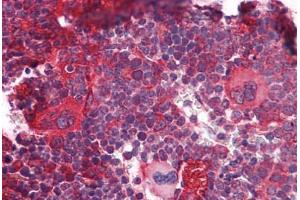 Mouse Lymphoid Tissue: Formalin-Fixed, Paraffin-Embedded (FFPE)