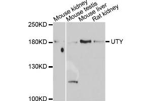 Western blot analysis of extracts of various cell lines, using UTY antibody.