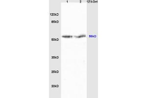 Lane 1: rat liver lysates Lane 2: rat brain lysates probed with Anti Cyp2-j3 Polyclonal Antibody, Unconjugated (ABIN872965) at 1:200 in 4 °C.