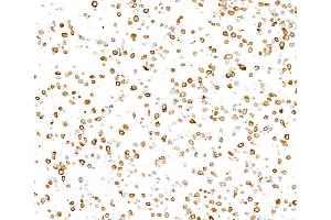 Immunocytochemistry (ICC) image for anti-Keratin 8 (KRT8) (C-Term) antibody (ABIN7795706)