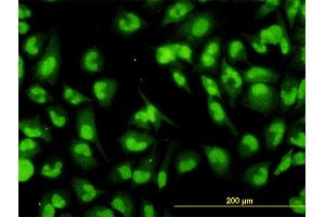 Immunofluorescence of monoclonal antibody to DHX9 on HeLa cell. (DHX9 Antikörper  (AA 1-90))