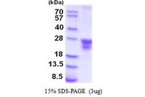 SDS-PAGE (SDS) image for HLA-DR-gamma (CD74) (AA 73-232) protein (His tag) (ABIN5854298) (CD74 Protein (AA 73-232) (His tag))