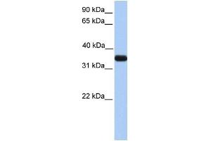 ApoE antibody used at 1 ug/ml to detect target protein.