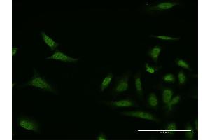 Immunofluorescence of monoclonal antibody to MKNK1 on HeLa cell. (MKNK1 Antikörper  (AA 1-100))