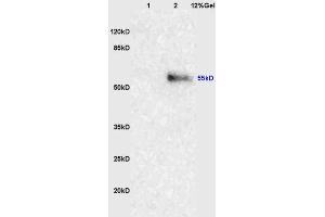 Lane 1: mouse lung lysates Lane 2: human colon carcinoma lysates probed with Anti-NRF-1 Polyclonal Antibody, Unconjugated (ABIN675219) at 1:200 in 4 °C.